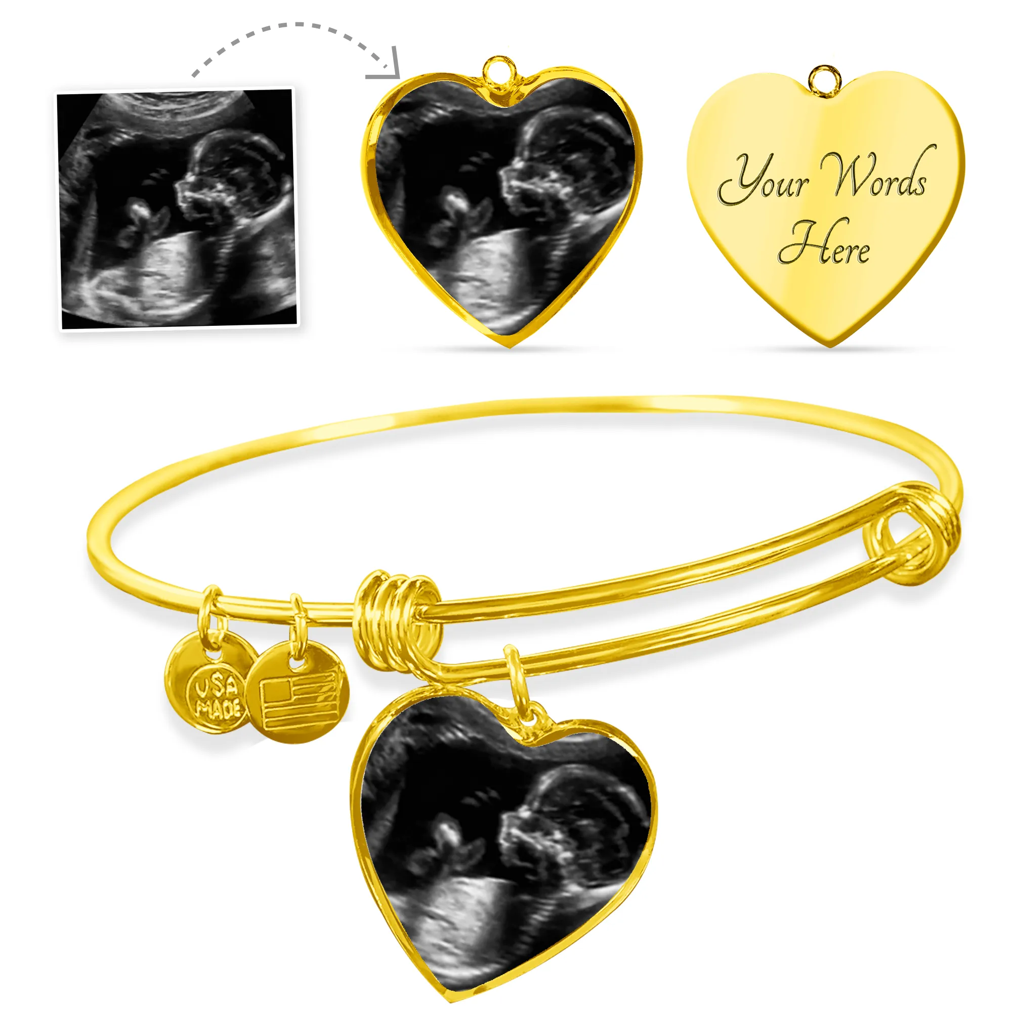 Infant Loss Miscarriage Keepsake Jewelry Baby Ultrasound Photo Bangle Bracelet